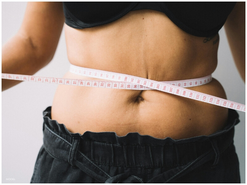 liposuction