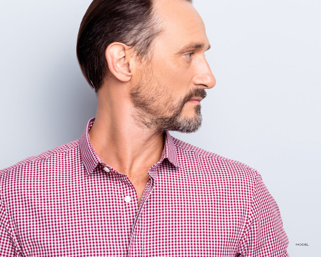 Rhinoplasty