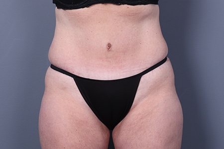 After